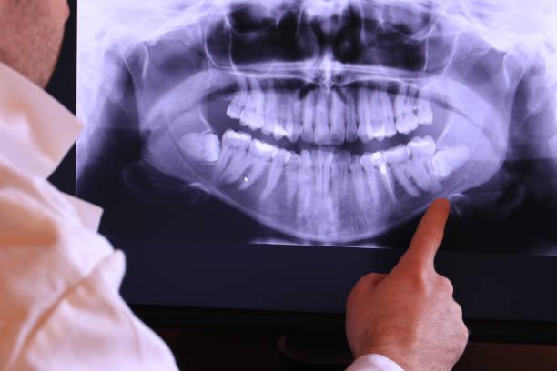 Best Emergency Orthodontic Repairs in Robert Lee, TX